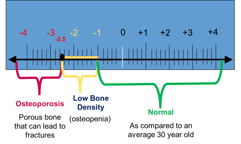 Bone Mass Percentage Chart By Age