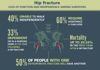 hip fracture infographic